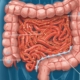 photo of leaky gut